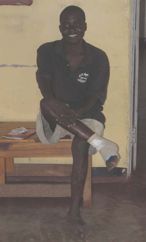 15 A burn patient